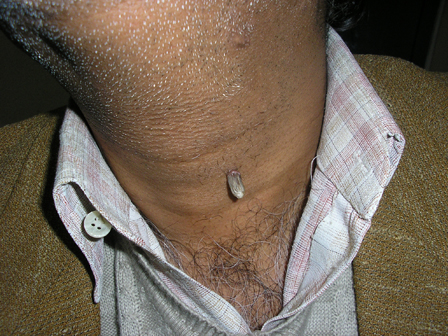 Dr Pandya Clinic Udaipur